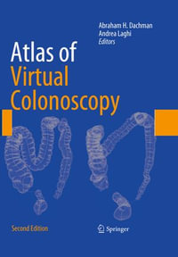 Atlas of Virtual Colonoscopy : Comprehensive Atlas and Fundamentals - Andrea Laghi