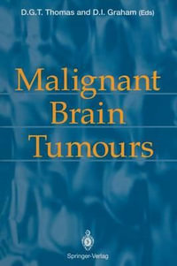 Malignant Brain Tumours - David G.T. Thomas