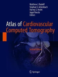 Atlas of Cardiovascular Computed Tomography - Matthew J. Budoff