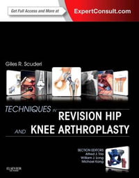 Techniques in Revision Hip and Knee Arthroplasty 1e - Giles Scuderi