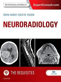 Neuroradiology : The Requisites - Rohini Nadgir