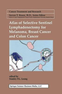 Atlas of Selective Sentinel Lymphadenectomy for Melanoma, Breast Cancer and Colon Cancer : Cancer Treatment and Research - Stanley P. L. Leong