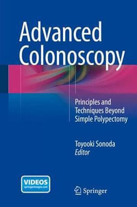 Advanced Colonoscopy : Principles and Techniques Beyond Simple Polypectomy - Toyooki Sonoda