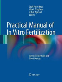 Practical Manual of In Vitro Fertilization : Advanced Methods and Novel Devices - Zsolt Peter Nagy