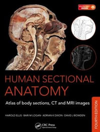 Human Sectional Anatomy : Atlas of Body Sections, CT and MRI Images, Fourth Edition - Adrian K. Dixon