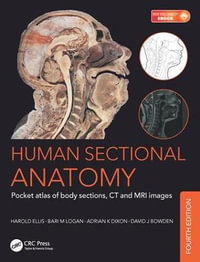 Human Sectional Anatomy : Pocket atlas of body sections, CT and MRI images, Fourth edition - Adrian Kendal Dixon