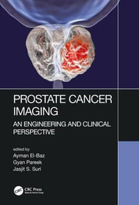 Prostate Cancer Imaging : An Engineering and Clinical Perspective - Ayman El-Baz