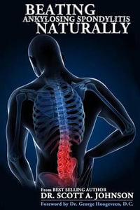 Beating Ankylosing Spondylitis Naturally - Scott A. Johnson