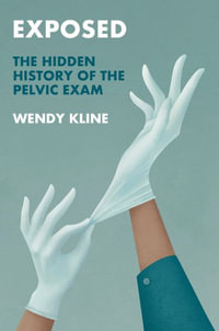 Exposed : The Hidden History of the Pelvic Exam - Wendy Kline