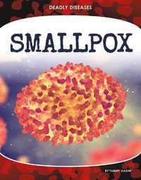 Smallpox : Deadly Diseases - Tammy Gagne