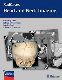 RadCases Head and Neck Imaging : Radcases Plus Q &A - Gaurang Shah