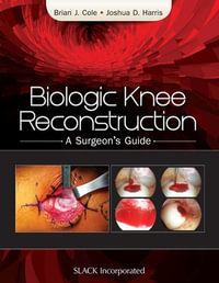 Biologic Knee Reconstruction : A Surgeon's Guide - Brian Cole