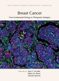 Breast Cancer : From Fundamental Biology to Therapeutic Strategies - Jane E Visvader