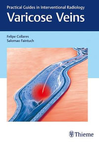 Varicose Veins : Practical Guides in Interventional Radiology - Felipe Collares