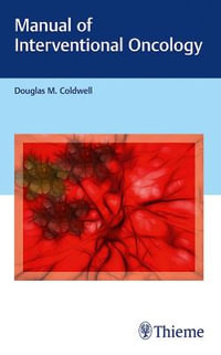 Manual of Interventional Oncology - Douglas M. Coldwell