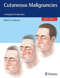 Cutaneous Malignancies : A Surgical Perspective plus videos - Brian Gastman