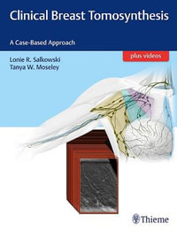 Clinical Breast Tomosynthesis : A Case-Based Approach plus videos - Lonie R. Salkowski