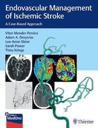 Endovascular Management of Ischemic Stroke : A Case-Based Approach - Vitor Pereira