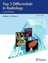 Top 3 Differentials in Radiology : A Case Review - William T. O'Brien