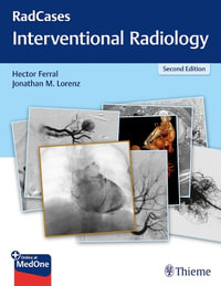 Interventional Radiology : Radcases : 2nd Edition - Hector Ferral