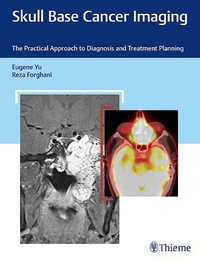 Skull Base Cancer Imaging : Practical Approach to Diagnosis and Treatment Planning - Eugene Yu