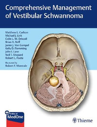 Comprehensive Management of Vestibular Schwannoma - Matthew L. Carlson
