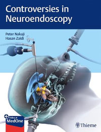 Controversies in Neuroendoscopy - Peter Nakaji