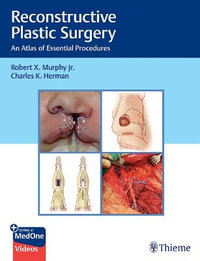 Reconstructive Plastic Surgery : An Atlas of Essential Procedures - Robert Murphy