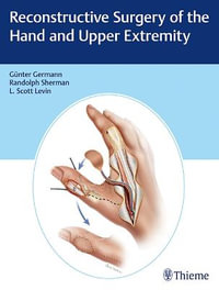 Reconstructive Surgery of the Hand and Upper Extremity - Gunter Germann