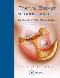 Partial Breast Reconstruction : Techniques in Oncoplastic Surgery : 2nd Edition - Albert Losken