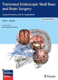 Transnasal Endoscopic Skull Base and Brain Surgery : 2nd Edition : Surgical Anatomy and its Applications - Aldo C. Stamm