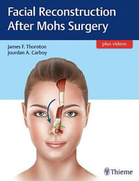 Facial Reconstruction After Mohs Surgery : Plus videos - James Thornton