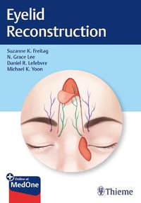 Eyelid Reconstruction - Suzanne Freitag