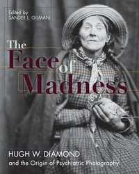 Face of Madness : Hugh W. Diamond and the Origin of Psychiatric Photography - Sander L. Gilman