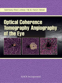 Optical Coherence Tomography Angiography of the Eye : OCT Angiography - Bruno Lumbroso