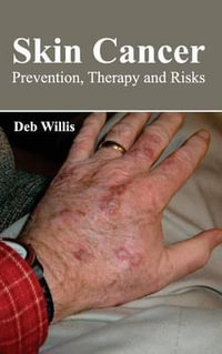 Skin Cancer : Prevention, Therapy and Risks - Deb Willis