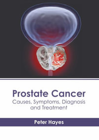 Prostate Cancer : Causes, Symptoms, Diagnosis and Treatment - Peter Hayes