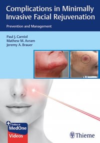 Complications in Minimally Invasive Facial Rejuvenation : Prevention and Management - Paul J. Carniol