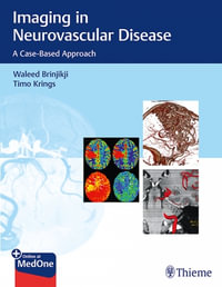 Imaging in Neurovascular Disease : Case-Based Approach - Waleed Brinjikji