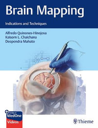 Brain Mapping : Indications and Techniques - Alfredo Quinones-Hinojosa