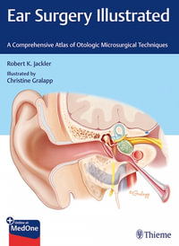 Ear Surgery Illustrated : Comprehensive Atlas of Otologic Microsurgical Techniques - Robert Jackler