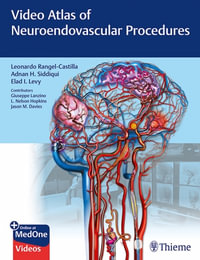 Video Atlas of Neuroendovascular Procedures - Leonardo Rangel-Castilla