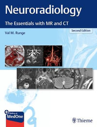 Neuroradiology : 2nd Edition - The Essentials with MR and CT - Val M. Runge