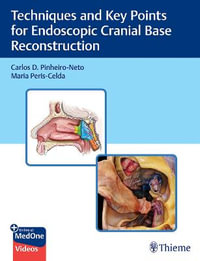 Techniques and Key Points for Endoscopic Cranial Base Reconstruction - Carlos Pinheiro-Neto