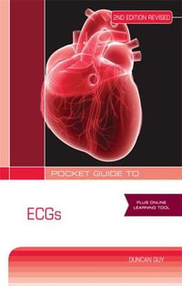 Pocket Guide to ECGs, 2nd Edition : Australia Healthcare Medical Medical - Duncan Guy