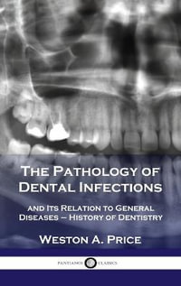 Pathology of Dental Infections : and Its Relation to General Diseases - History of Dentistry - Weston a. Price