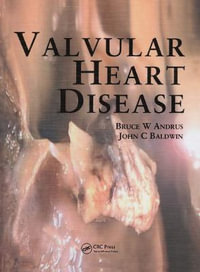 Valvular Heart Disease : MANSON - Bruce Andrus