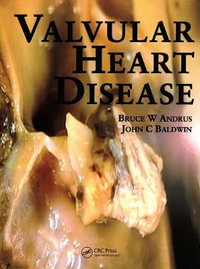 Valvular Heart Disease : MANSON - Bruce Andrus