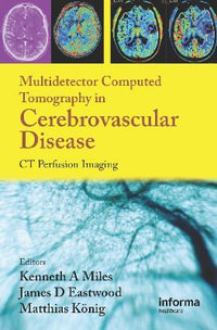 Multidetector Computed Tomography in Cerebrovascular Disease : CT Perfusion Imaging - Kenneth Miles