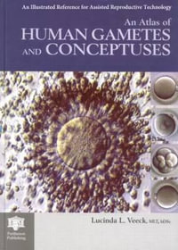 An Atlas of Human Gametes and Conceptuses : An Illustrated Reference for Assisted Reproductive Technology - Lucinda L. Veeck